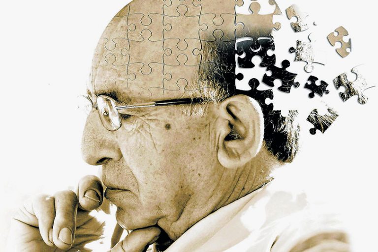 Tratamento de Alzheimer: tudo o que você precisa saber