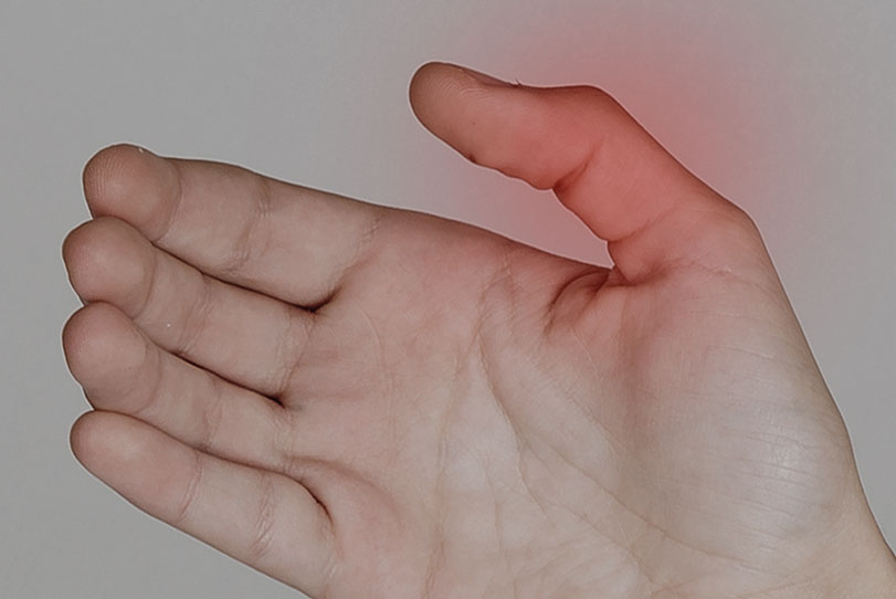 Tenossinovite de Quervain: causas e tratamentos para a dor no polegar